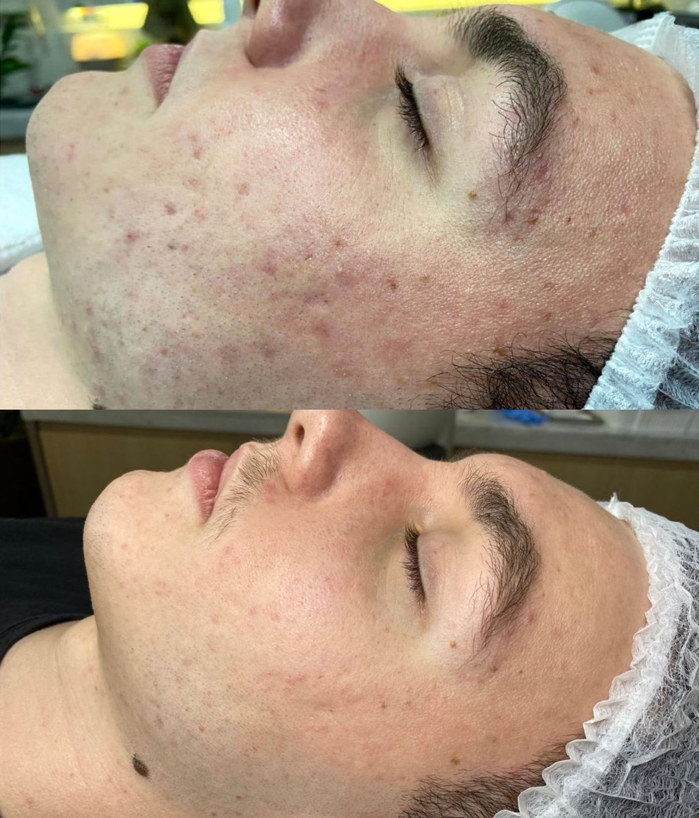Tratamento facial personalizado em Piracicaba
